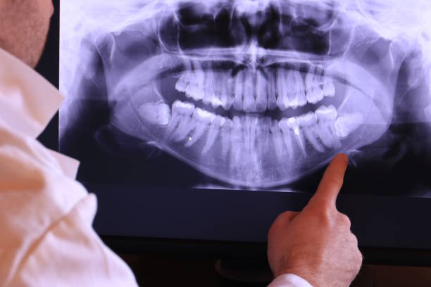  Boronda, CA Emergency Dentist Pros