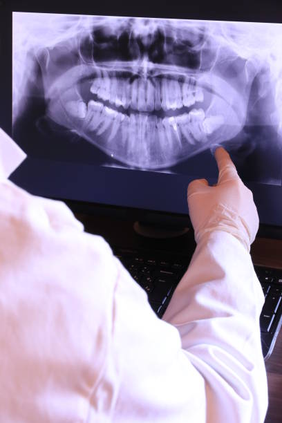 Best Broken Tooth Emergency  in Boronda, CA