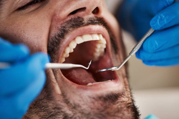 Best Cracked Tooth Emergency Dentist  in Boronda, CA